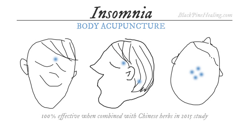 Acupuncture and Herbs for Insomnia 100% Effective
